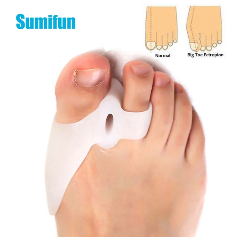 4pairs=8pcs Soft Big Toe Separator Corrector Silicone Gel Foot Fingers Bone Bunion Adjuster Hallux Valgus Pedicure Tool D2541