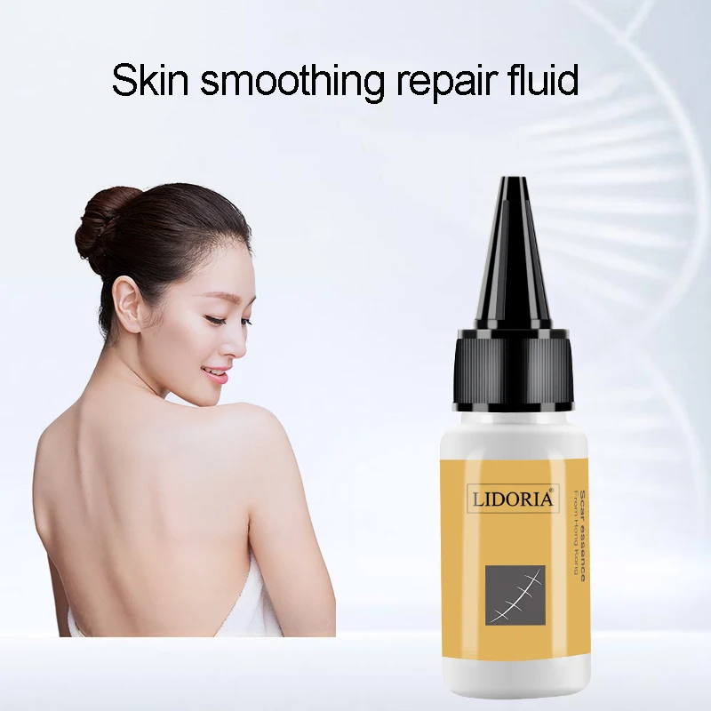 1pc 20ml Herbal Scar Mark Removal Skin Whole Body Care Cream Blemish Treatment Skin Scar Smoothing Repair Fluid Skincare TSLM1