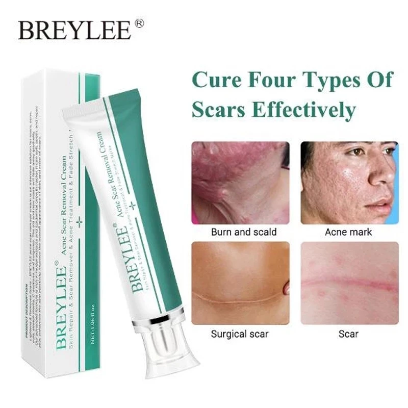 BREYLEE Scar Removal Cream Skin Care Face For Acne Stretch Remove Maternity Treatment Repair | Красота и здоровье