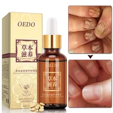 Травяная восстанавливающая жидкость для ногтей высокого качества 30 мл Лечение грибка для ногтей онихомикоз удаление противогрибковый Уход за ногтями жидкость TSLM1