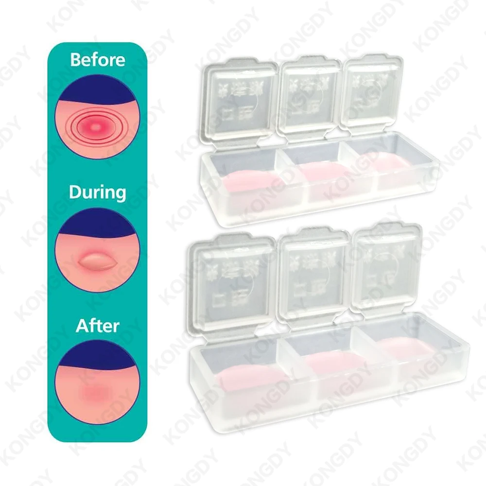 Oral Canker Sore Stickers Effective Mouth Ulcer Treatment Mouth Sole Cover Patch Fast Healing Safe Antibacterial Film 6PCS/BOX
