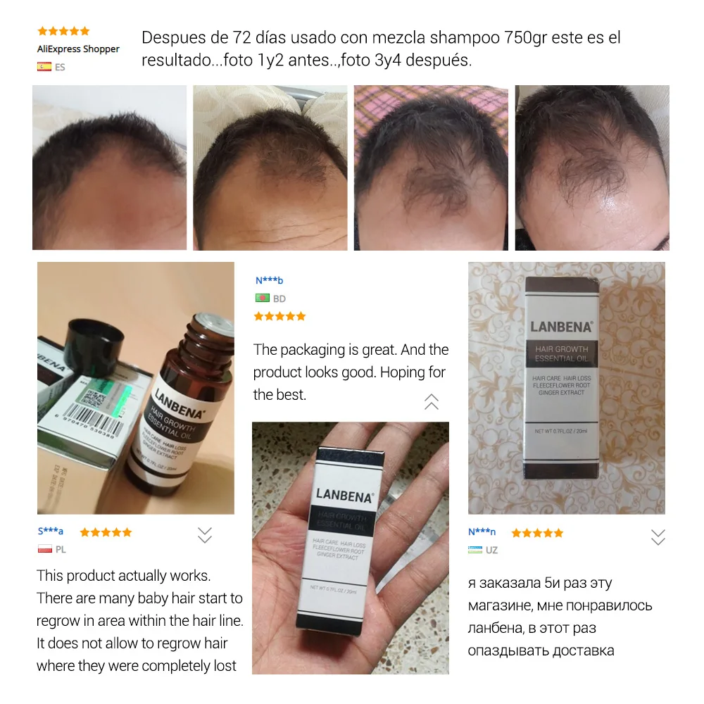 LANBENA Ginger Fast Powerful эфирное масло для роста волос продукты лечения и предотвращения