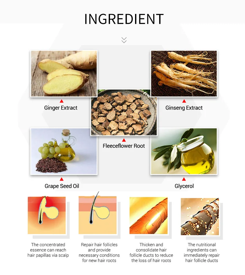 2 шт Имбирь против выпадения волос сыворотка для роста эссенция для быстрого роста волос густые волосы Восстанавливающий имбирь Сыворотка против выпадения продукты для лечения