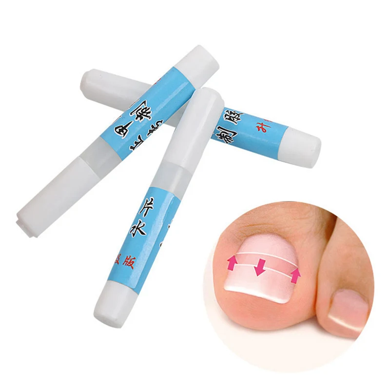 

3g Nail Glue Ingrown Toe Nail Correction Pedicure Patch Adhesive Foot Care Tools Can Dropshipping