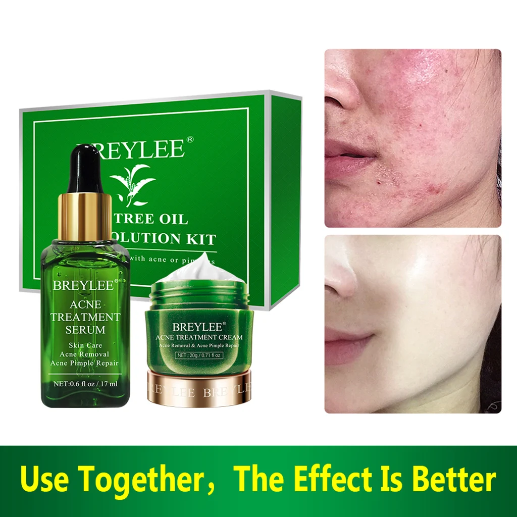 BREYLEE Acne Treatment Face Serum Mask Anti Acne Pimple Scar Remover Moisturizing Whitening Skin Care Facial Essence Cream