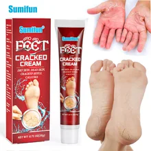 

20G Chapped Moisturizing Ointment Cracked Heel Cream Skin Anti Dry Peeling Callus Dead Skin Removal Medical Plaster Health Care