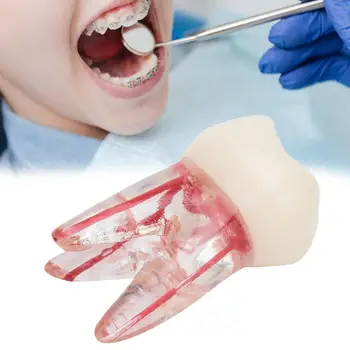 

Dentistry 1:1 Dental Teeth Model Endodontic Student Study Practice Operation Tool with Colored Root Canal Transparent Pulp