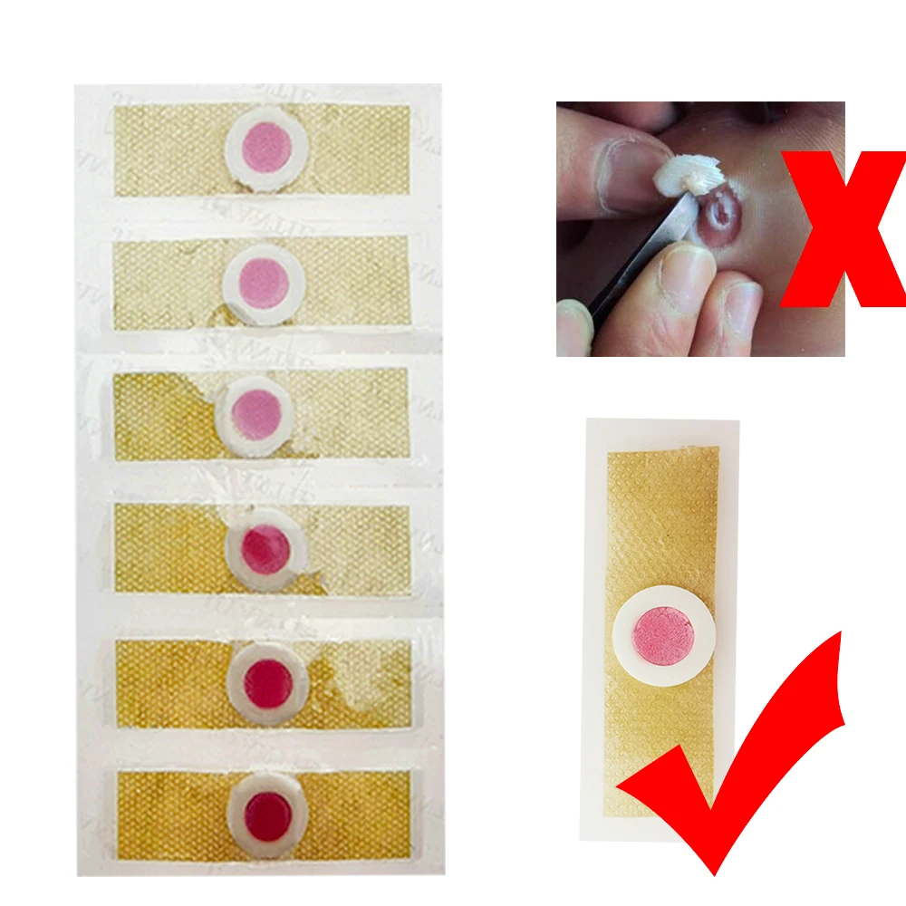 6pcs Medical Plasters Foot Corn Removal Warts Thorn Patch Curative Patches Calluses Callosity Detox Foot Pads Toe Patches H044
