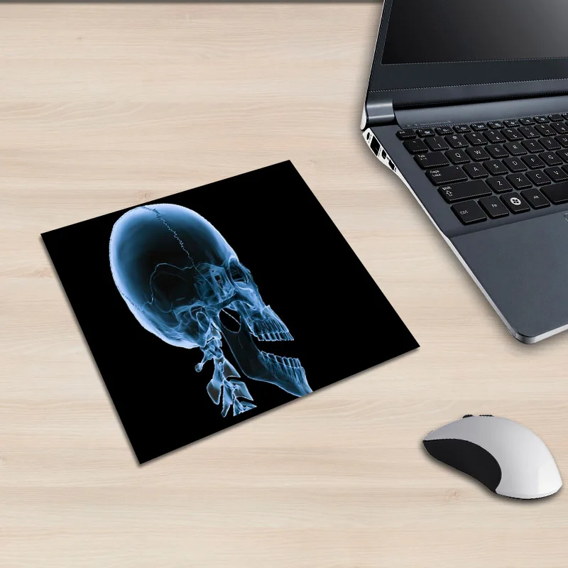 XGZ ноутбук X-ray Man Imaging Picture квадратный коврик для мыши для верховой езды гиена хип-хоп PC коврик колесо скейтборд резиновый противоскользящий Универсальный - Цвет: 250X290X2MM