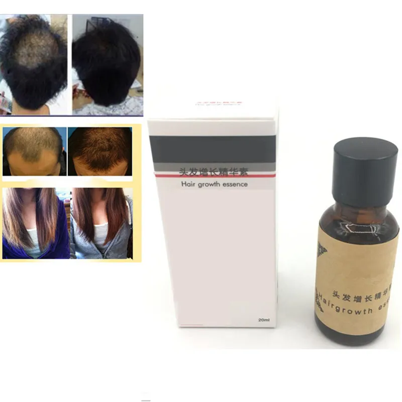 Hair Growth Ginger Oil Natural Plant Essence Hair Tonic Beard Eyelashes Grow Serum for Hair Shampoo Hair Loss Products