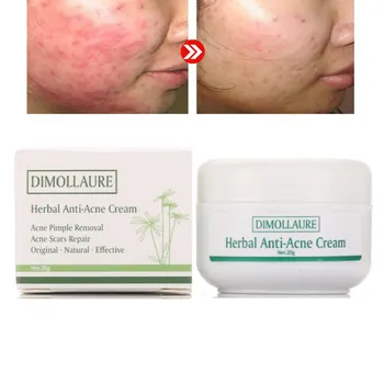 

Dimollaure Herbal Acne Cream Anti Pimple Spot Acne Scars Pimple Blackhead Removal Cream Whitening Shrink Pore skin Care cream