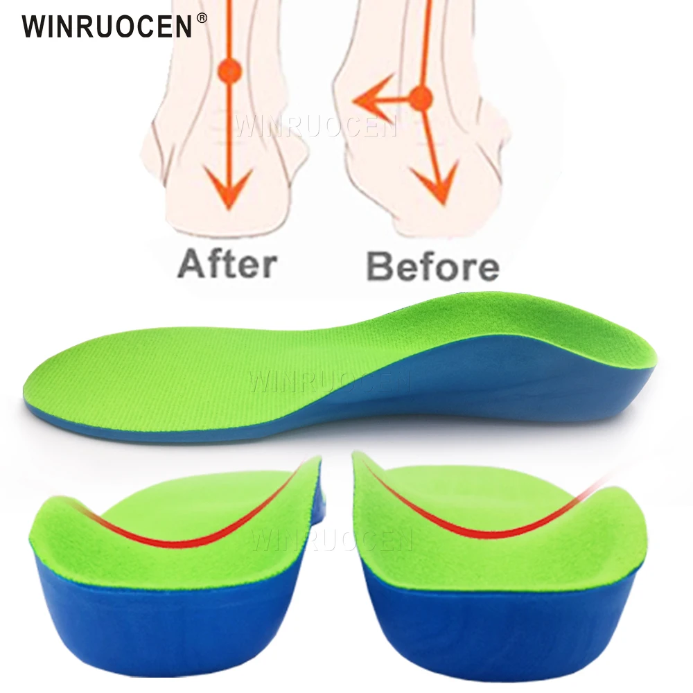 Best Price Insoles Shoes Inserts Arch-Support-Orthotics Flat-Feet Professional Child Plantillas-Pad 4000864639206