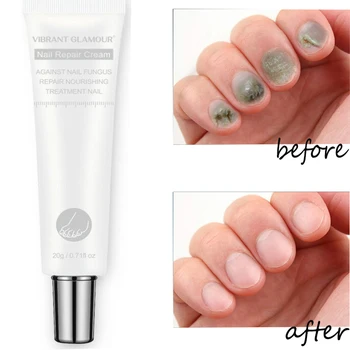 

20g Nail Care Nail Foot Protection Cream Skin Care Cream Fungus Treatment Herbal Nail Repair Cream