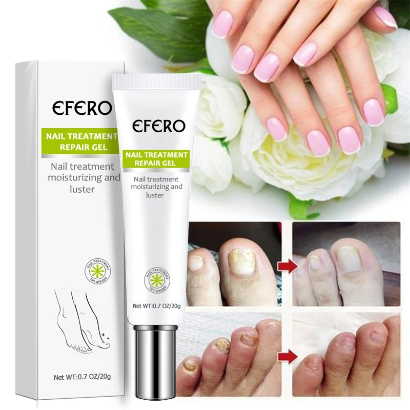 

EFERO Fungal Nail Treatment Serum Nail Foot Nail Fungus Removal Gel Anti Infection Onychomycosis Nail Repair Essence Cream TSLM1