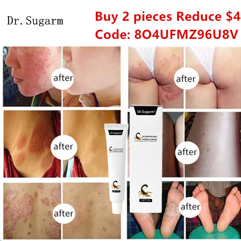 Dr. sugarm eczema psoríase creme para atletas pé, jock coceira, micose, eczema, picadas de mosquito, erupção cutânea, pé e creme para o corpo