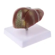 Human Liver Pathological Anatomical Model Anatomy School Medical Teaching Display Tool Lab Equipment human liver medical model anatomical model medical science teaching supplies human liver model vivid liver model gasen xh012