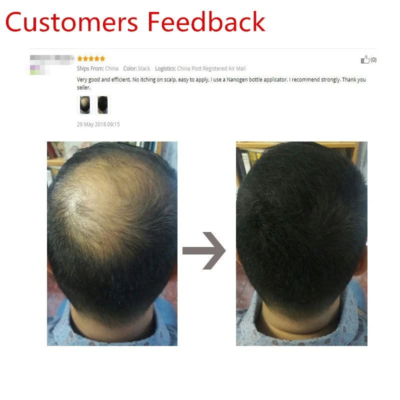 Sevich Beauty Hair Loss Treatment Concealer Hair Fiber Keratin Building Fibre Styling powder Refill 25g 10colors hair building powder hair building fibers