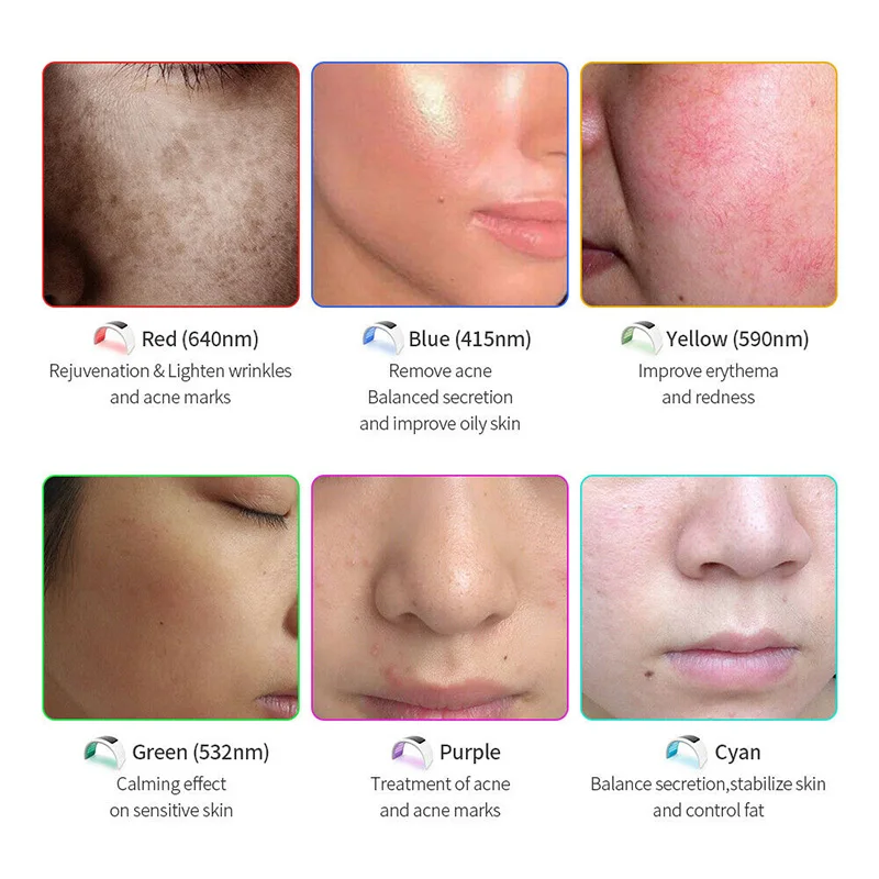 Рисунок 4 - Светодиодный ная PDT маска для лица