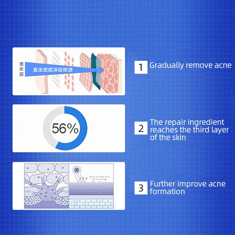 30ml Herbal Acne Mark Repair Gel Moisturizing Lightening Pigment Acne Skin Care Repair Acne Pit Skin Care