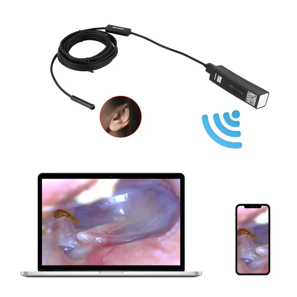 F170 беспроводной WiFi ушной очиститель эндоскоп 5 мм объектив Otoscope воск для удаления