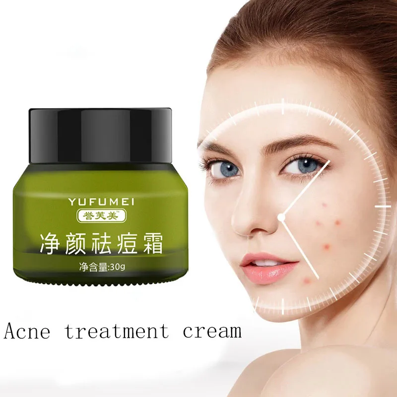 

Acne Treatment Face Cream Anti Acne Scar Removal Pimple Blackhead Moisturizing Whiten Oil-control Shrink Pores Skin Care