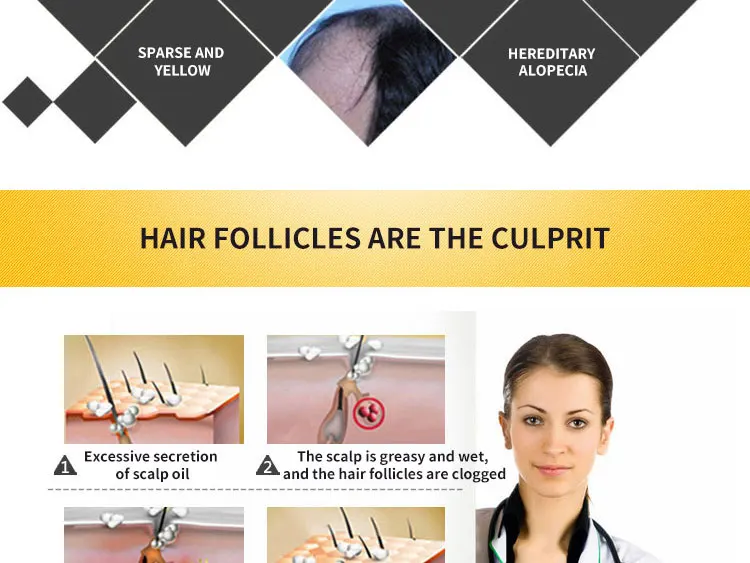 Эссенция для роста волос масло против выпадения волос для роста волос лечение для выпадения волос толщийся тоник для волос сыворотка для волос продукты по уходу за волосами