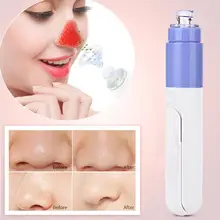 Портативный Электрический вакуумный очиститель угрей для лица красота пор очищающее средство от акне отшелушивающее устройство для очищения лица Уход за кожей