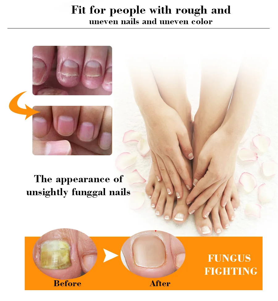 EFERO инструменты для ухода за ногтями крем для ремонта ногтей противогрибковый средство для ухода за кожей крем для ногтей средство для удаления кутикул Onychomycosis Уход за ногтями