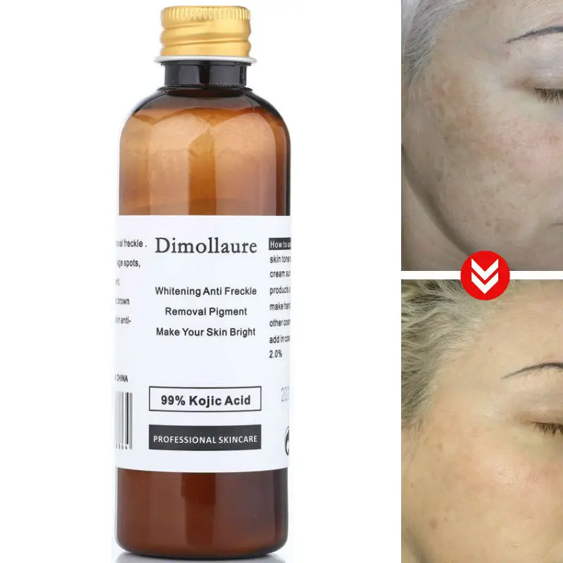 Порошок койевой кислоты Dimollaure99 % 30 г Отбеливающее бриллиантовое средство для