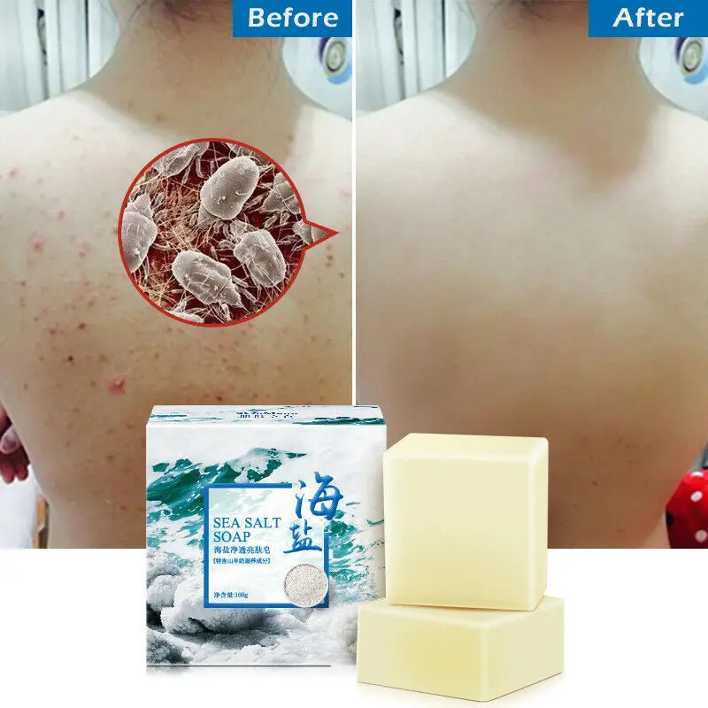 

100g Removal Pimple Pore Acne Treatment Sea Salt Soap Cleaner Moisturizing Goat Milk Soap Face Care Wash Basis Soap