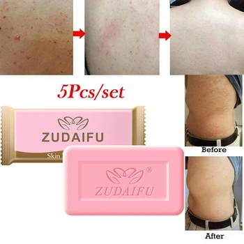 

Sulfur Soap Anti-mites Anti-acne Soap Gift Set Control Oil Cleaning Pores Body Cleansing Soap Soap Base Skin Care*s