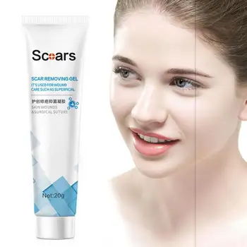 

Acne Treatment Gel Blackhead Remove Face Cream Shrink Pores Scar Remove Anti Acne Whitening Face Cream Skin Care Supplies
