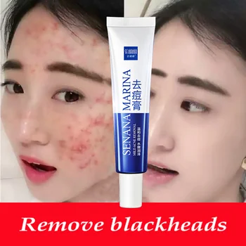 

LAIKOU Acne Treatment Gel Blackhead Remove Face Cream Shrink Pores Scar Remove Anti Acne Whitening Face Cream Skin Care