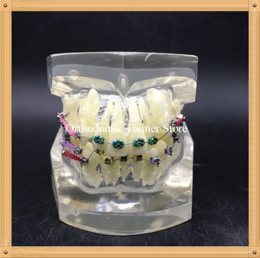 

Dental Orthodontic model with wire and bracket demonstrating orthodontic treatment/Fault Correction Orthodontic teeth model