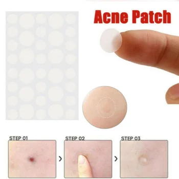 36pcs Hydrocolloid Acne Patch Set Invisible Pimple Skin Tag Remover Patch Blackhead Blemish Remover Cover