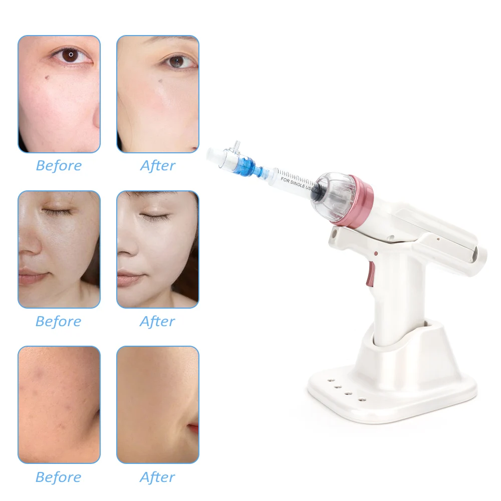 

Hydrolifting Gun Korea Mesotherapy EZ Negative Pressure Meso gun Mesotherapy Hydrolifting Water Injector Microcrystal Injection