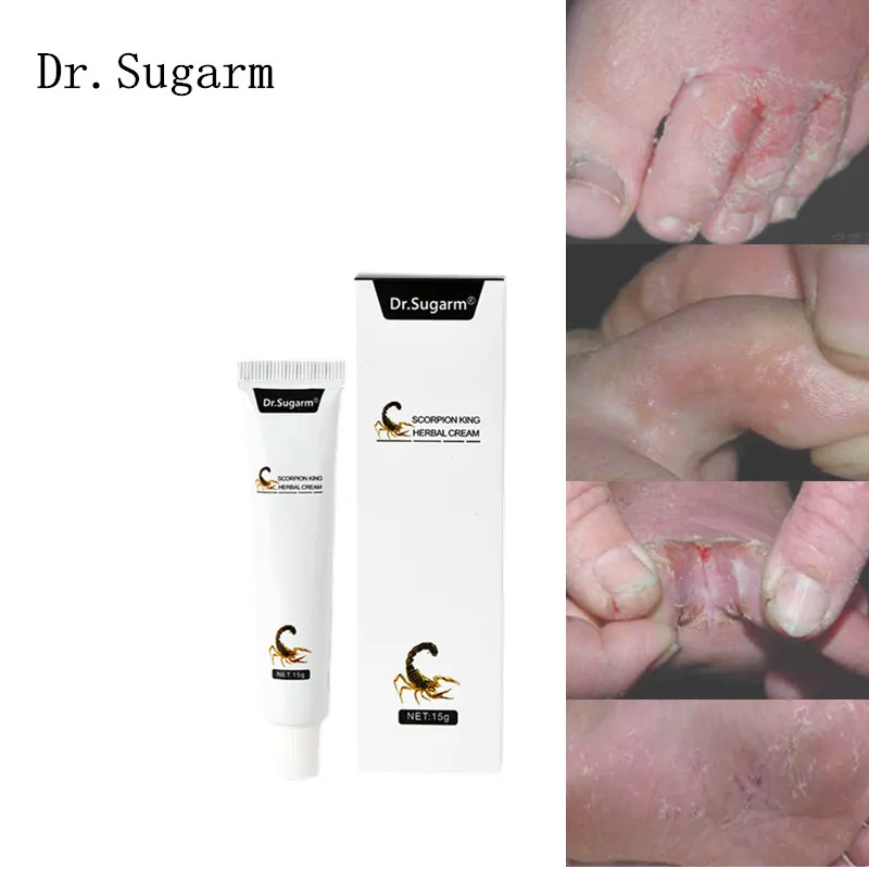 Травяное эффективное лечение ног Dr.Sugarm крем для тела против грибкового дерматита