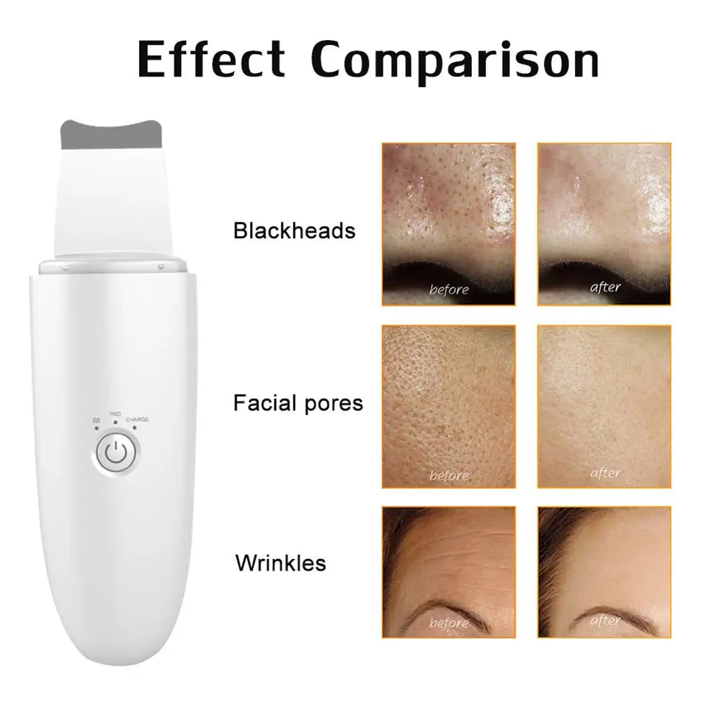 

Blackhead Removal Pores Cleanser Face Deep Pore Cleaner Acne Pimple Removal Vacuum Suction Facial Diamond Beauty Care Tool Ski