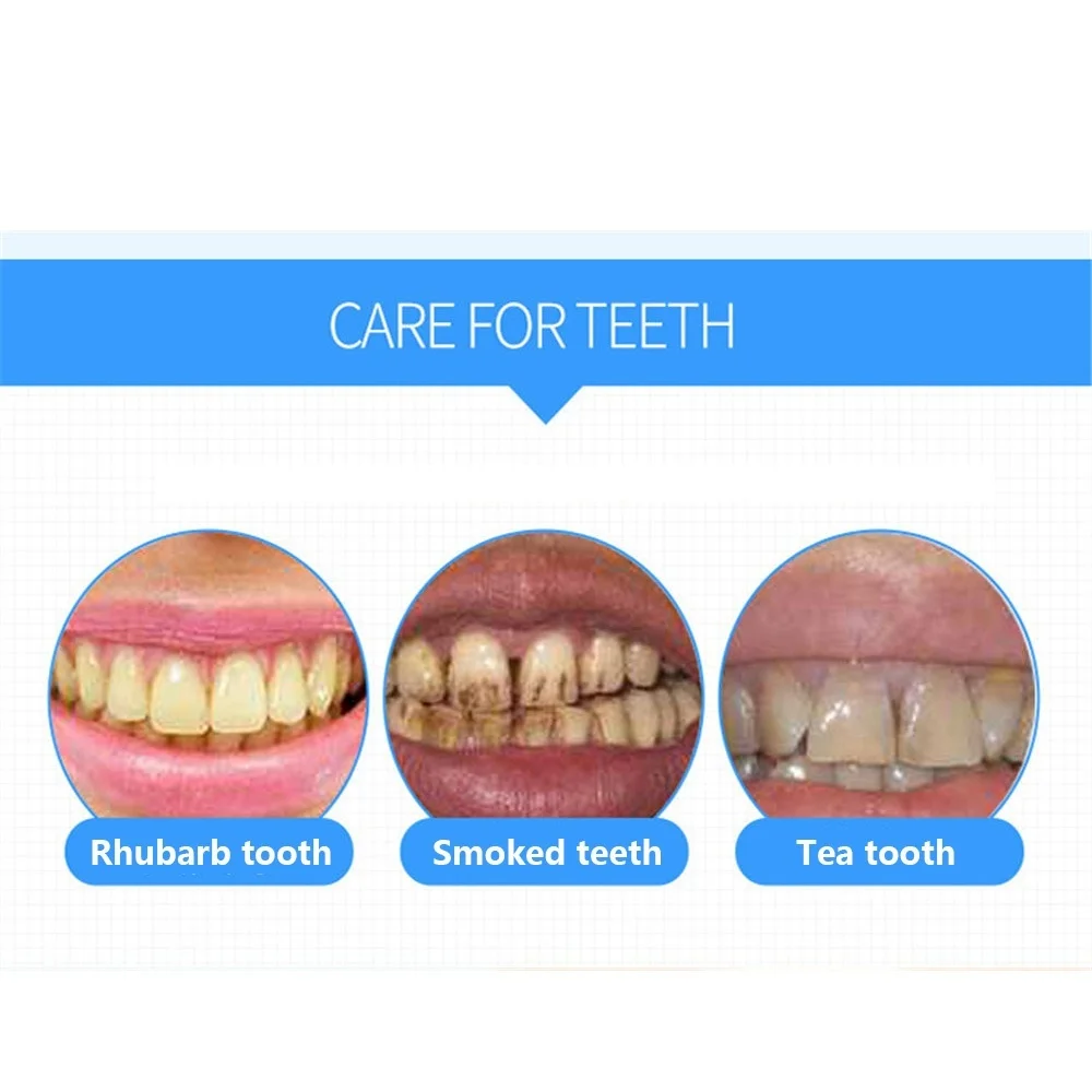Отбеливание зубов безопасно и эффективно удаляет много внешних пятен на зубах
