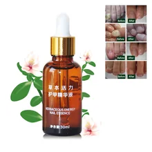 Профессиональная травяная китайская медицина Лечение ногтей эссенция удаление грибка для ног восстановление ногтей Уход за ногтями масло ремонт поврежденных ногтей