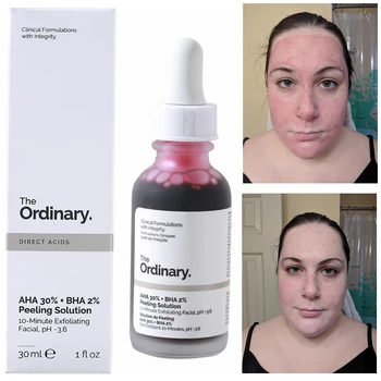 

The Ordinary Peeling Solution 30ml AHA 30% + BHA 2% to peel that dead top layer so that have fresh soft skin Foundation Makeup