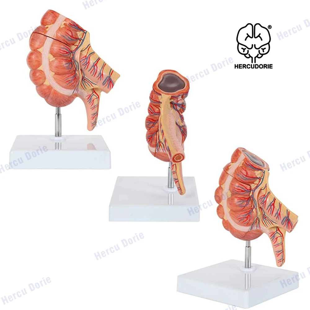

Caecum and Appendix Anatomy Model | Large Intestine Anatomy Model Enlarged 1.5 Times Life Size | Digestive System Anatomy Model