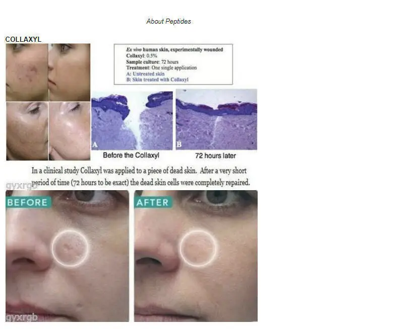 best collagen for acne scars