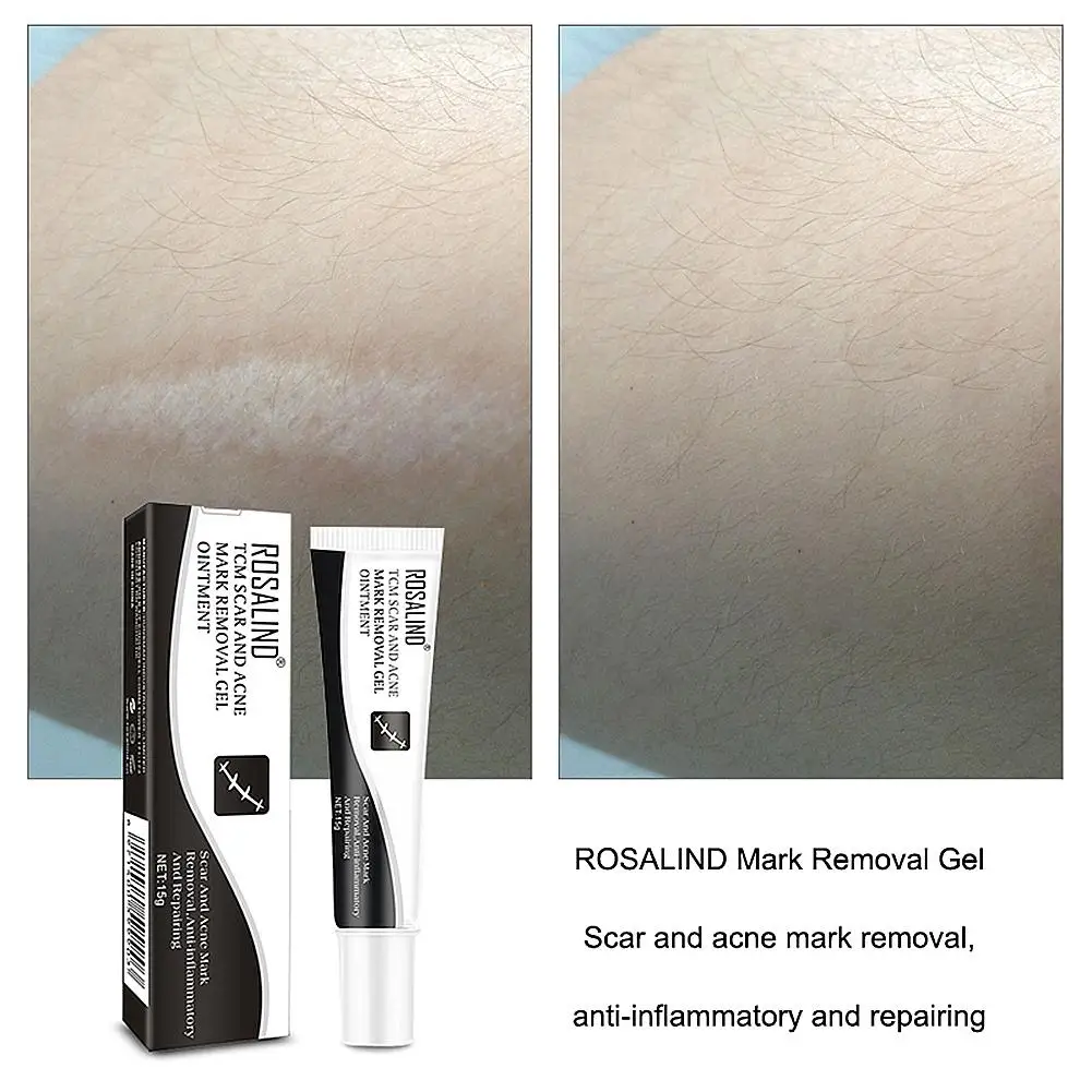 Pigmentation Ointment Scar Acne Face Cream Mark Removing Repairing Skin Cream Ginseng Essence Skin Care Gel Ointment