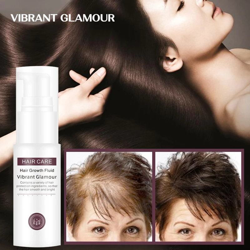 Spray Hair-Care Serum Grease Essential-Oil Scalp Prevent GLAMOUR VIBRANT Nourish Roots
