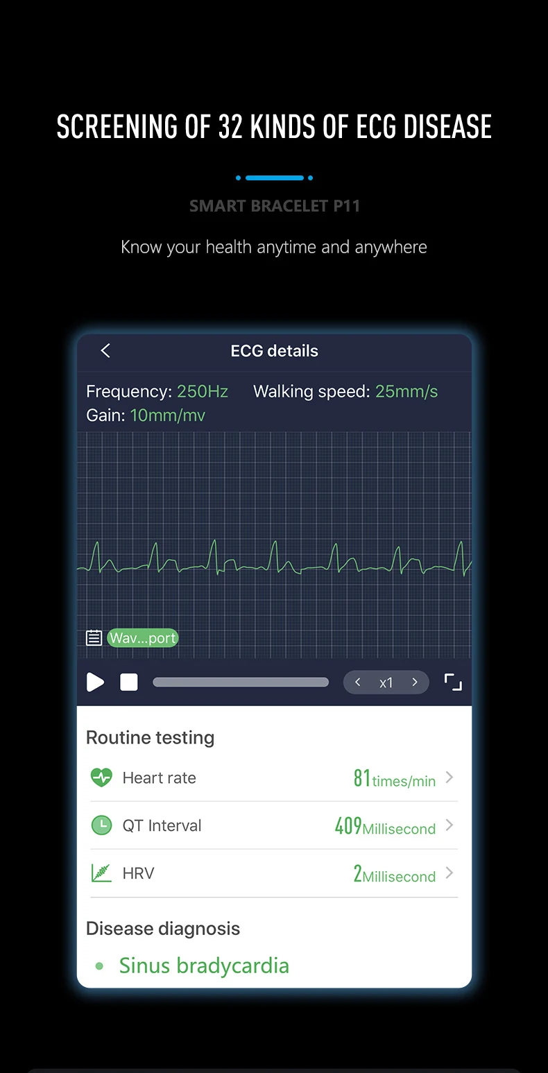 ECG+ PPG смарт-браслет кровяного давления HR монитор водонепроницаемый браслет Смарт часы Шагомер умный Браслет для IOS Android телефонов