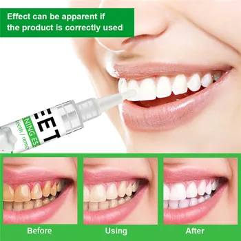 

Tooth Whitening Teeth Whitening Powder Toothpaste Dental Maquillaje Teeth Whitening Pen Remove Plaque Stains Oral Hygiene