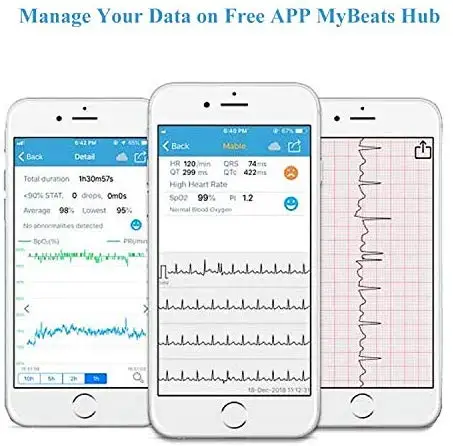 Portable Vital Signs Monitor with APP & PC Report ECG/EKG Monitor Pulse Oximeter Viatom Checkme Lit