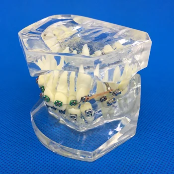 

dental teeth model Transparent pathological implant nerve Repair model Teaching demonstration model