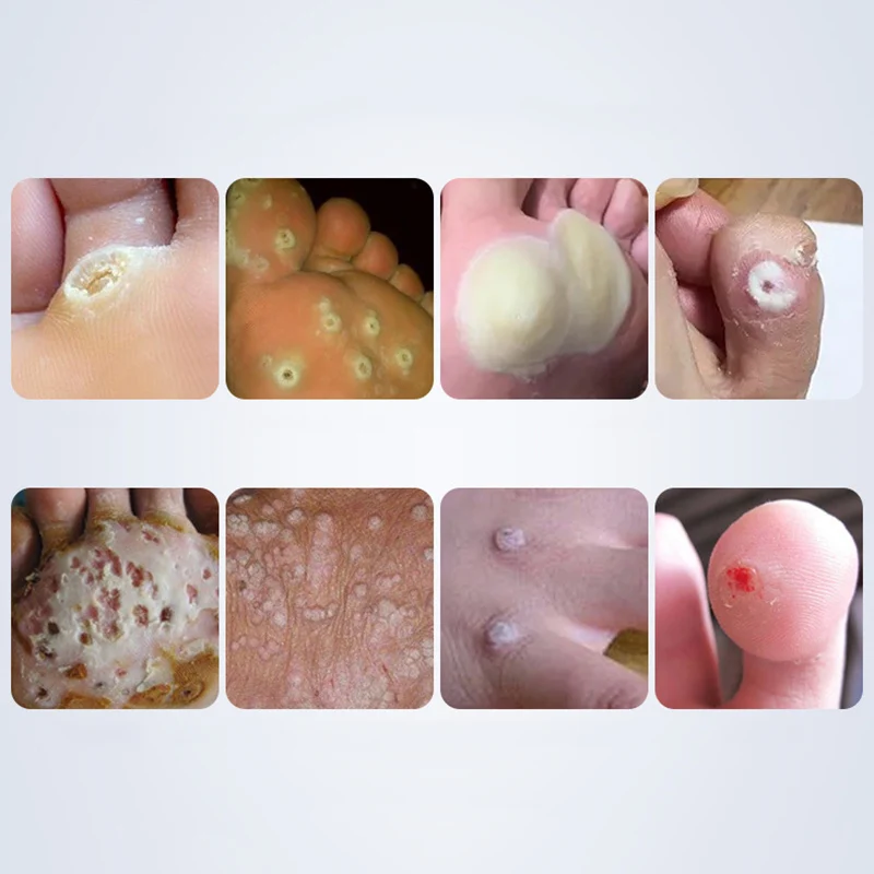 TF0253 (2)